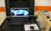 DIGITÁLNÍ RADIOGRAFIE (RENTGEN)